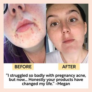 ECO FACE MOISTURISER WITH VITAMIN E + ALOE VERA - TRAVEL SIZE